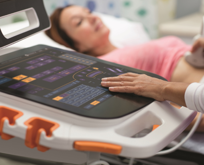 Carestream Touch Ultrasound Systems