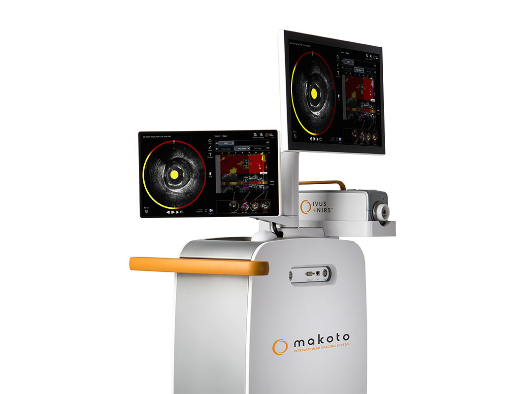 Infraredx Announces Launch of Makoto Intravascular Imaging System and Dualpro IVUS+NIRS Catheter in Japan