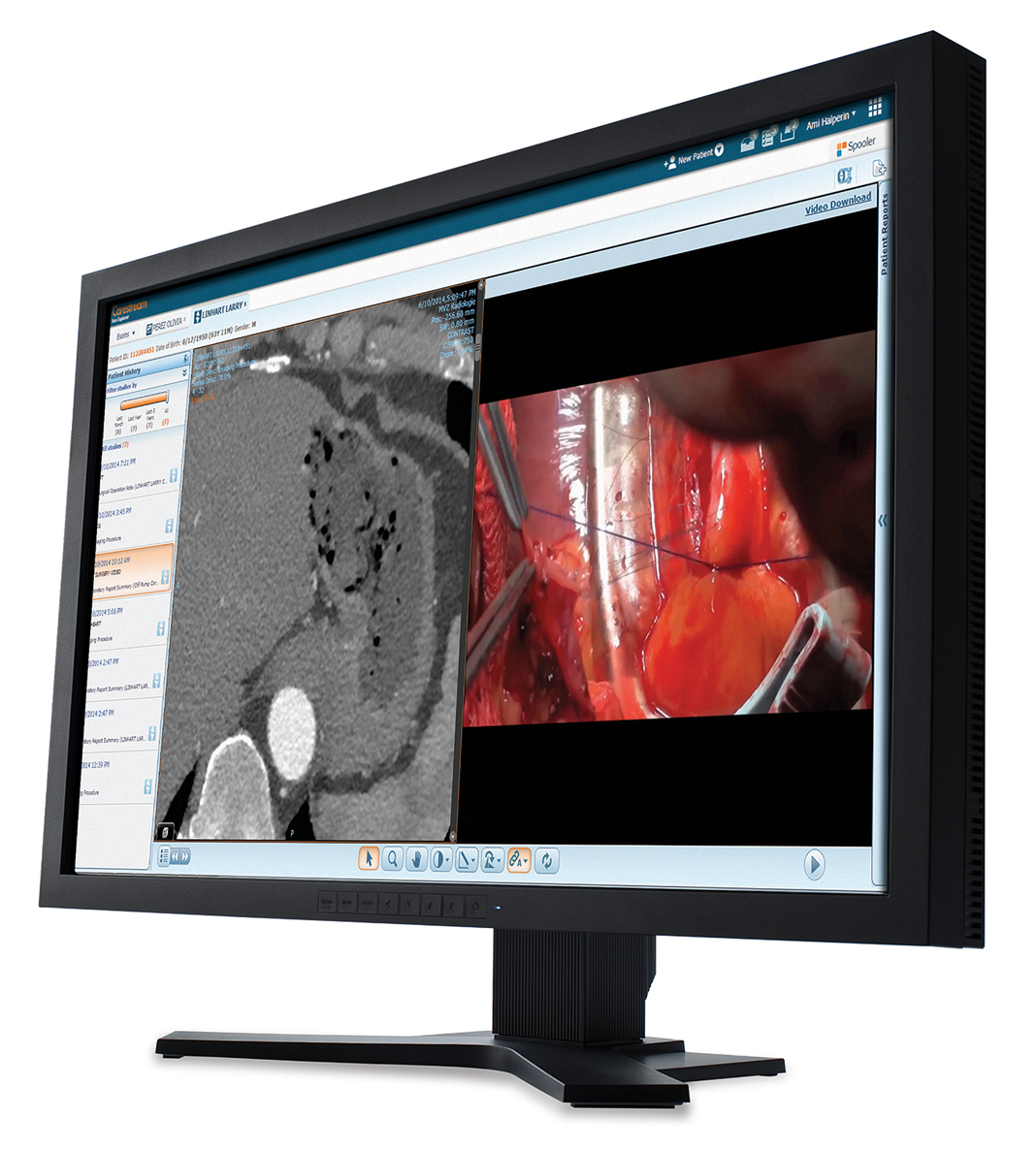Carestream’s Workflow Orchestrator Optimizes Radiologist Assignment, Productivity for Radiology Group