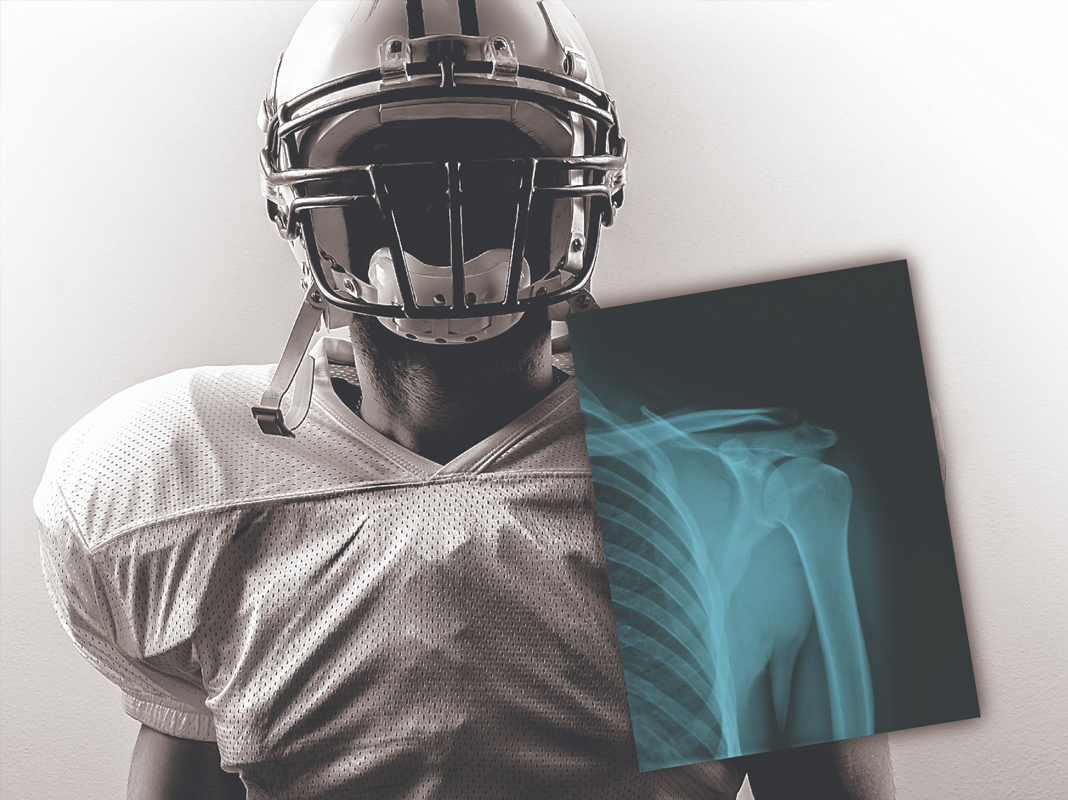 Carestream’s Latest Digital X-ray Technology Being Used at 2019 NFL Combine