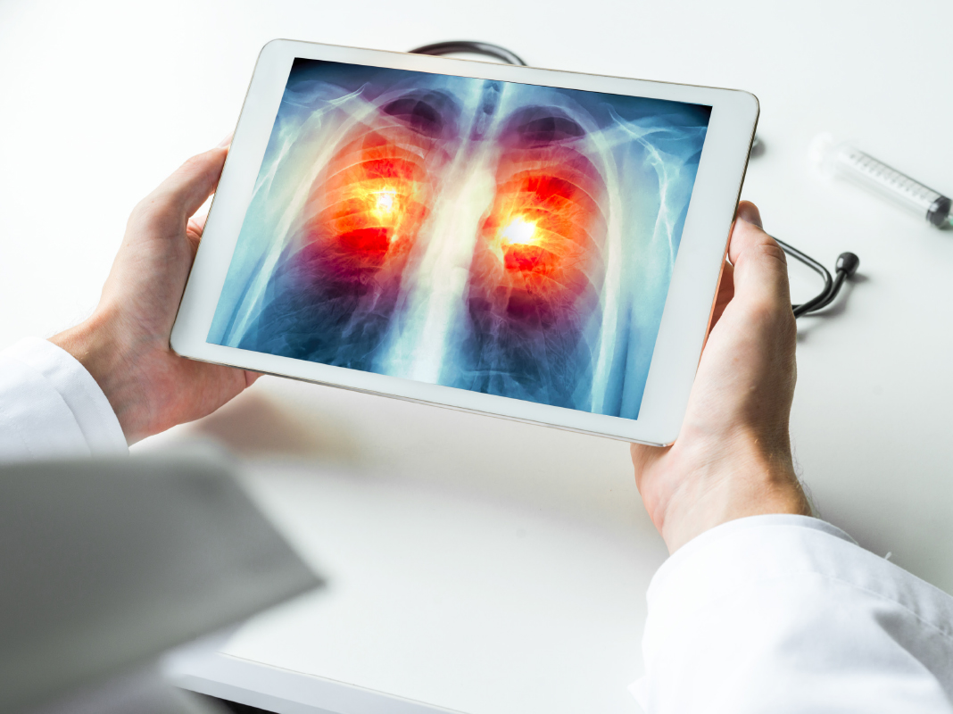 Digital Radiography Growth Fuels Detectors Market