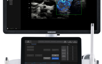 Samsung Introduces Latest Ultrasound System for Advanced Diagnostics