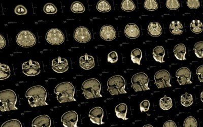 Report: AI-Enabled Medical Imaging Solutions Market to Reach $9.61 Billion