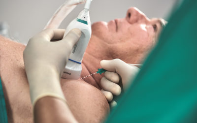 FDA Clears Onvision Needle Tip Tracking Technology for Regional Anesthesia