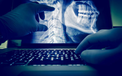 Report: Medical Image Analysis Software Market to Hit $4.5 Billion