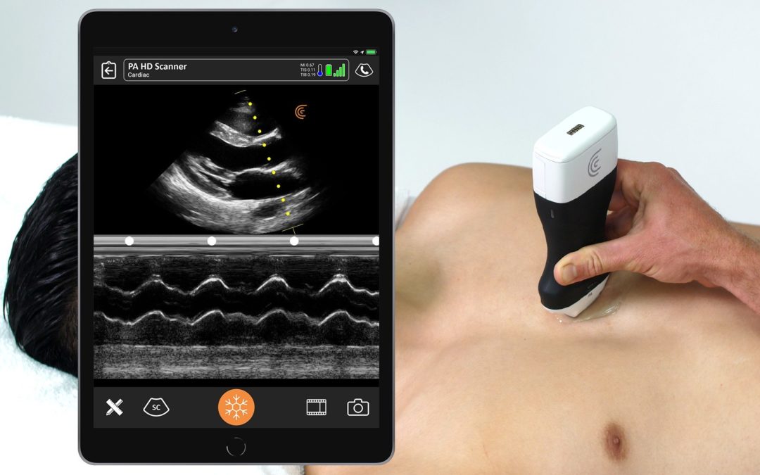 High-Definition Handheld Ultrasound Scanner Available for Rapid Bedside Cardiac Exams