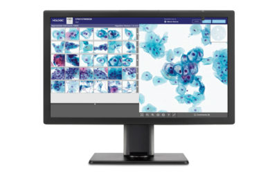 Hologic Announces CE Mark of the Genius Digital Diagnostics System for Cervical Cancer Screening