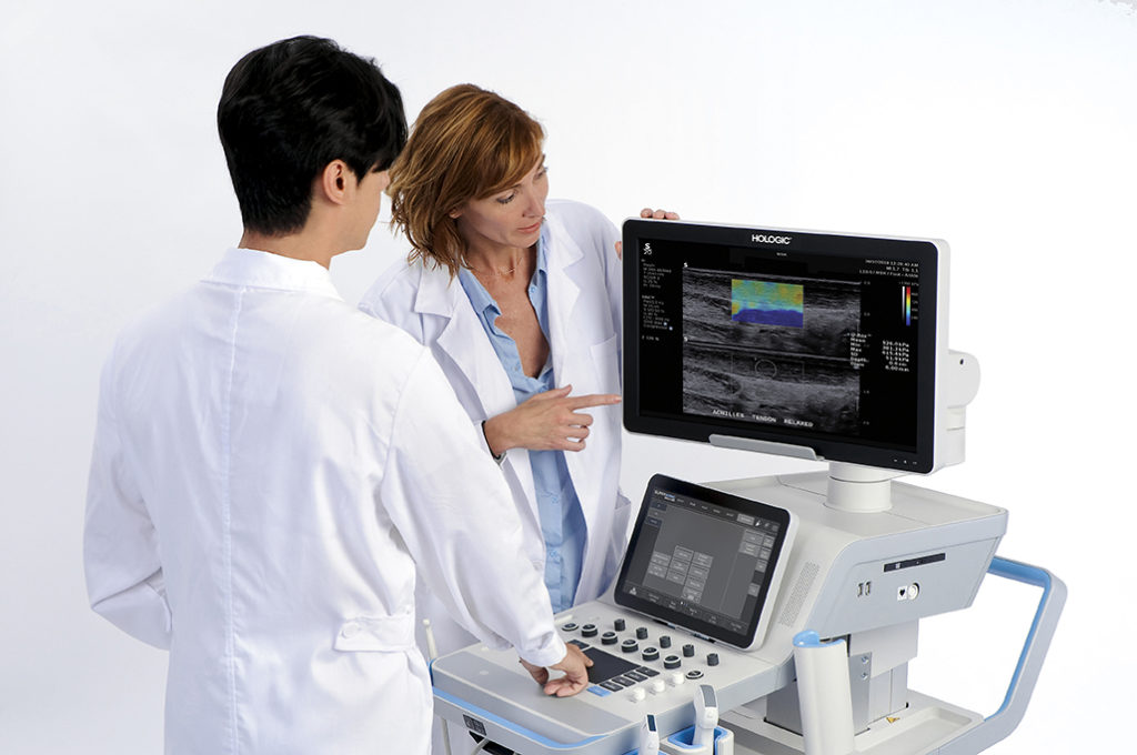 Hologic SuperSonic MACH 20 ultrasound system
