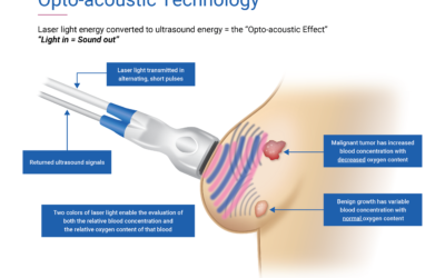 FDA Approves Seno Medical’s Breast Cancer Diagnostic Technology