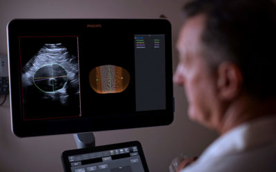 Philips Integrates 3D Ultrasound with Innovative Software for Breakthrough in Surveillance Of Abdominal Aortic Aneurysms
