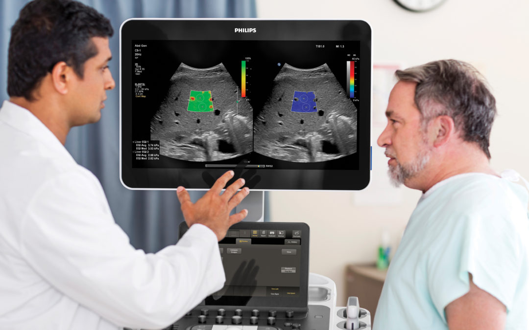 Philips Advances Ultrasound Portfolio