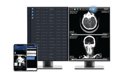 Studies: Viz.ai’s Cardio Suite Speeds Detection of Cardiac Disease and Improves Patient Follow-Up