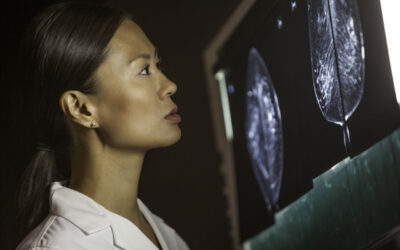Carestream DRYVIEW DVM+ Mammography Laser Imaging Film
