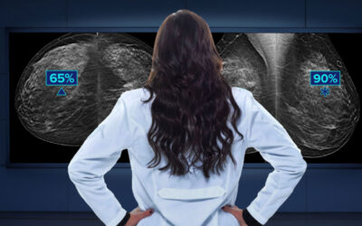 Hologic 3Dimensions Mammography System