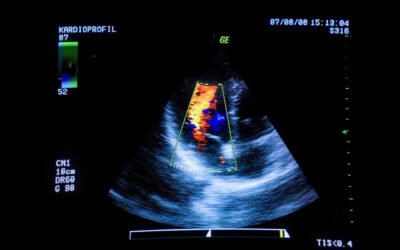 Ultrasound Market’s Growth Continues