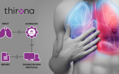 Thirona receives FDA 510(k) Clearance for LungQ Software