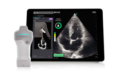 GE HealthCare Introduces Caption AI on Vscan Air SL Wireless Handheld Ultrasound System