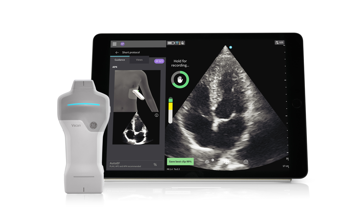 GE HealthCare Showcases Latest AI-Enhanced Cardiology Solutions