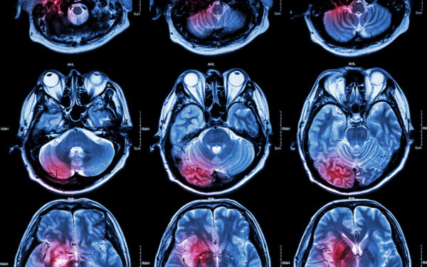Medical Imaging Market Continues to Climb