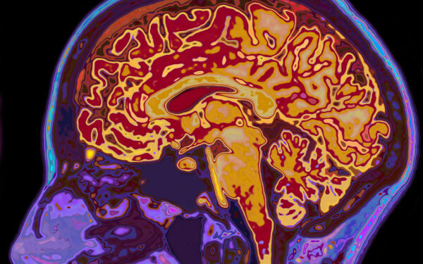 Rad Idea: CEM Offers Fast MRI