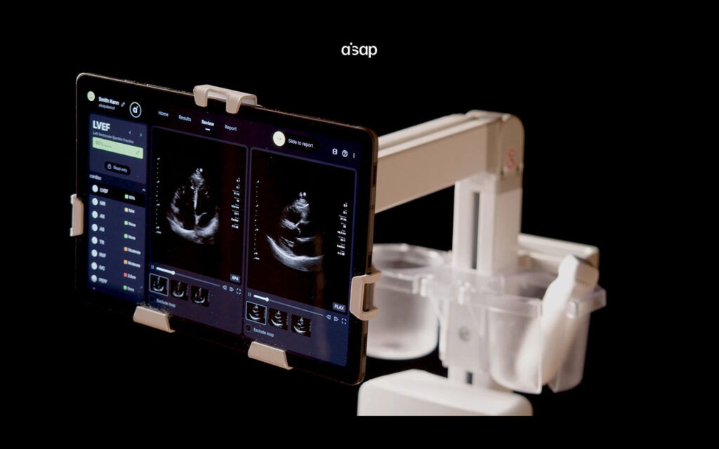AISAP's advanced AI-driven POCUS