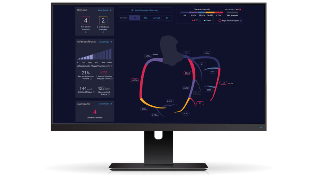 Bunkerhill Health and Cleerly Announce Strategic Partnership to Advance Noninvasive Cardiovascular Care