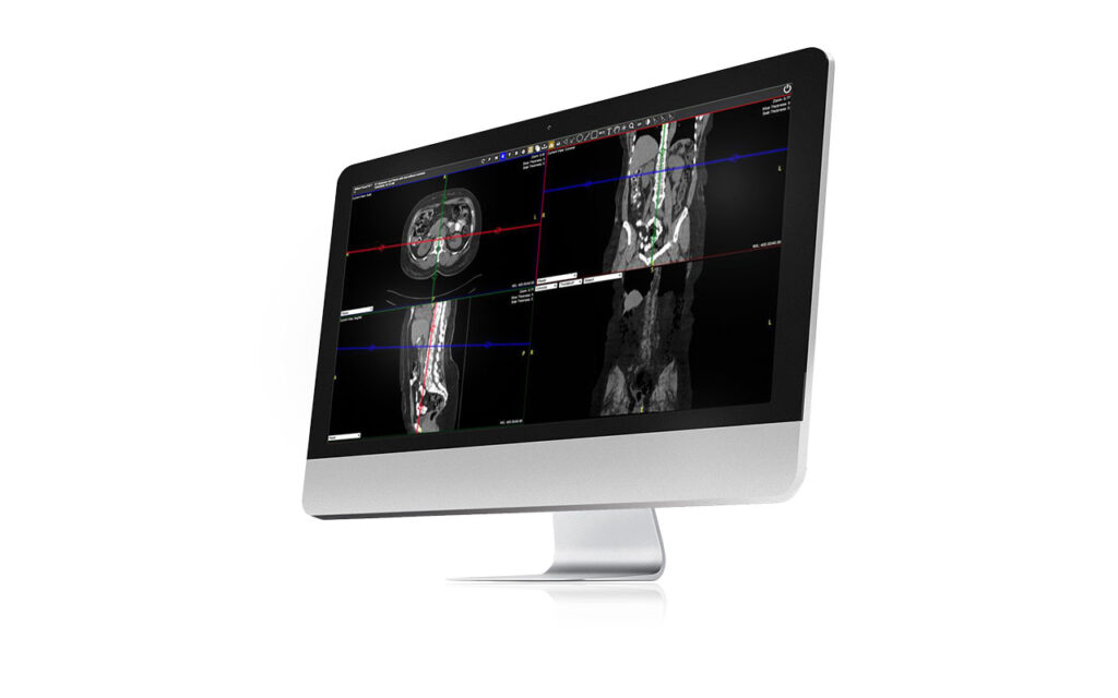 Next-Generation Exa Platform Features Embedded Advanced Visualization Functionality

