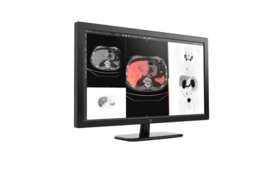 GE Healthcare Advances Precision Care with MIM Encore