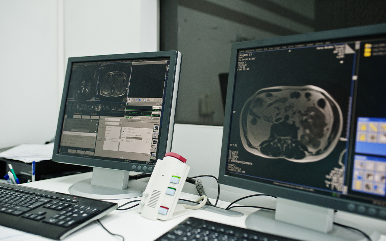 How ML Can Transform MRI Operations
