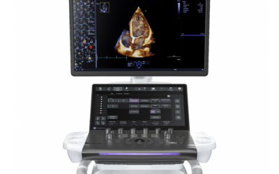 GE HealthCare unveils its most advanced AI-powered cardiovascular ultrasound system