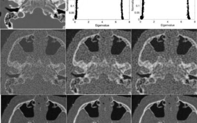 Clarifying Medical Images Using Next-Level Pixel-Particle Analogy