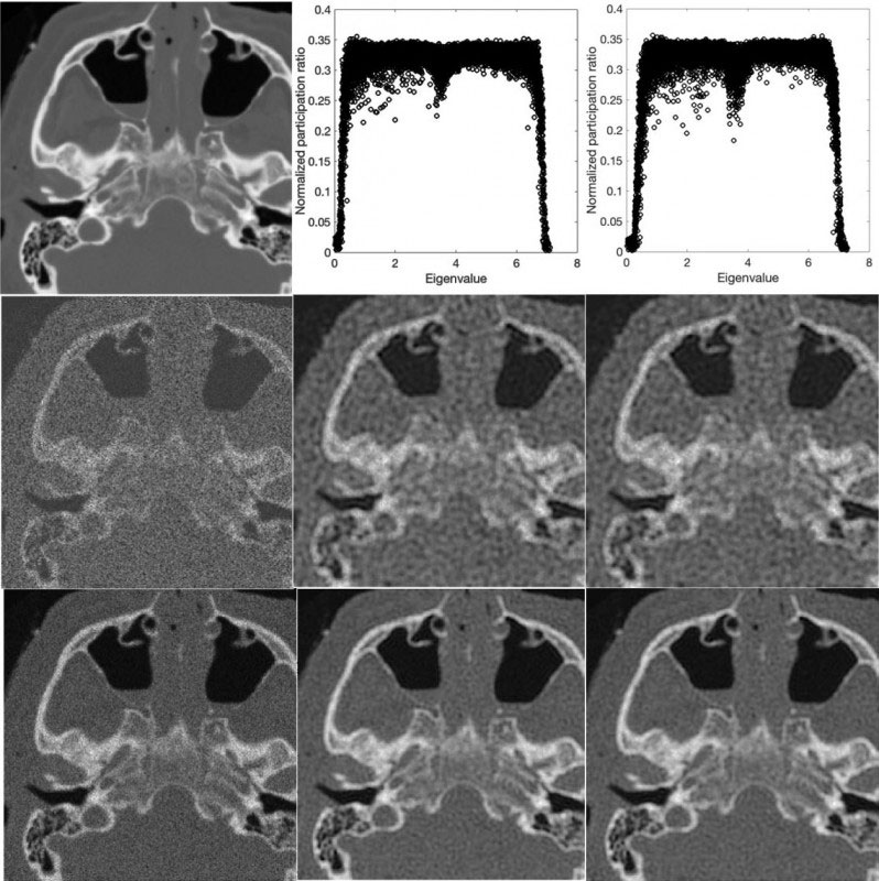Clarifying Medical Images Using Next-Level Pixel-Particle Analogy
