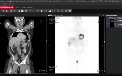 GE HealthCare Expands Access to Cloud-Enabled Enterprise Imaging Solutions in AWS Marketplace