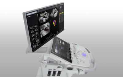 AI-enabled Voluson Performance Ultrasound Announced 