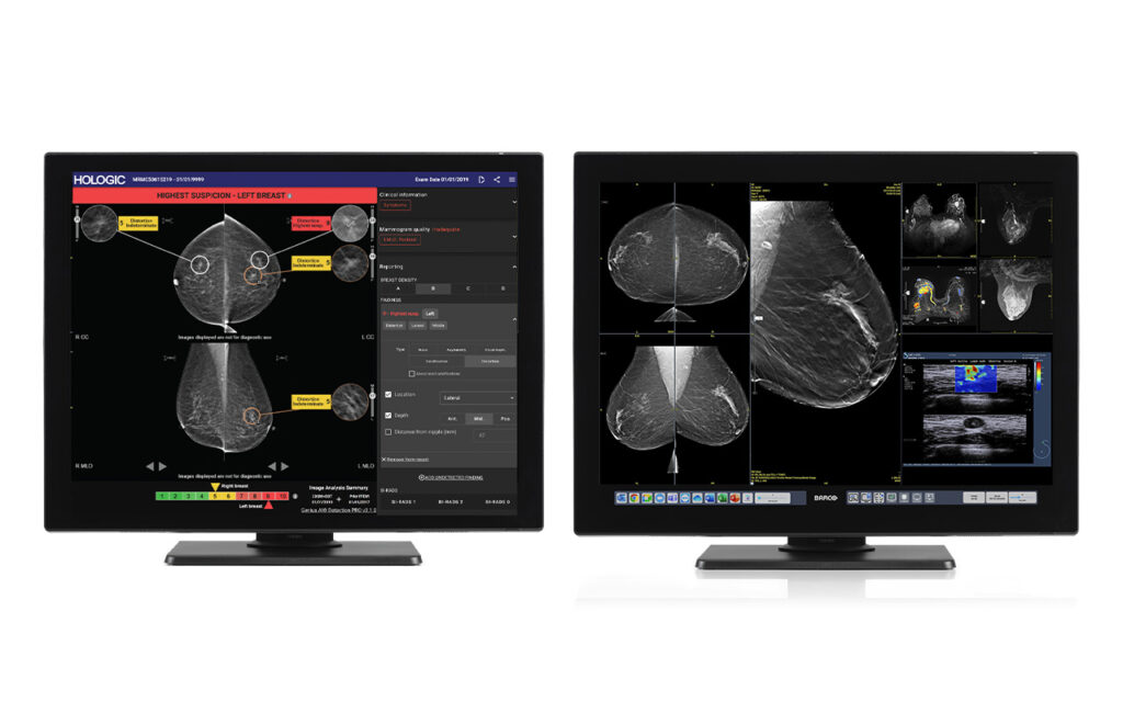 HOLOGIC Genius AI Detection  PRO Solution 