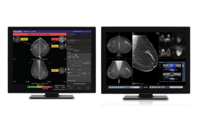 HOLOGIC Genius AI Detection  PRO Solution