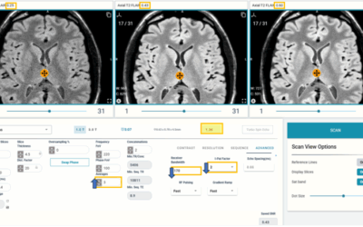ScanLab Launches Accurate SNR Calculator to Advance MRI Education & Protocol Optimization
