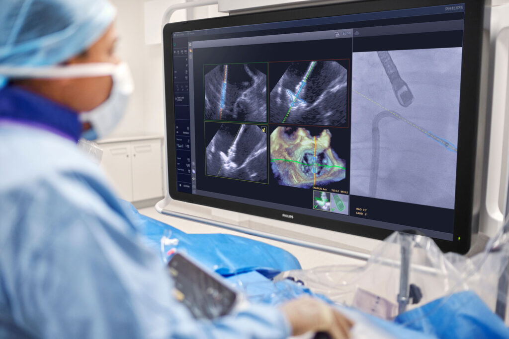 Philips Brings AI into Procedure Room 