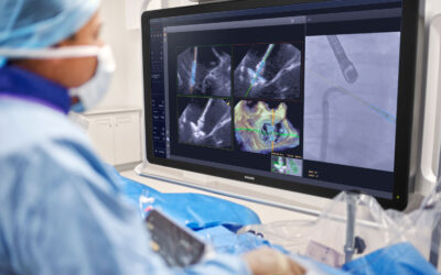 Philips Brings AI into Procedure Room