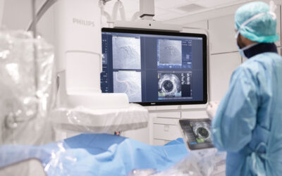 Philips to Acquire SpectraWAVE Inc.