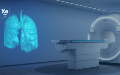 Study Demonstrates Xenon MRI Predicts Cystic Fibrosis Exacerbations