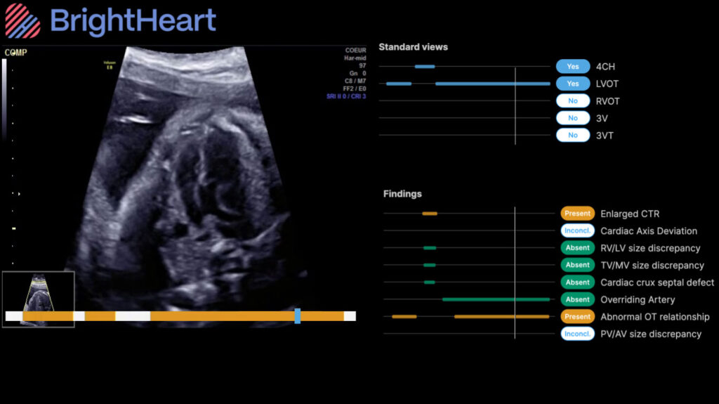 BrightHeart Announces Voluson Solution Store Collaboration

