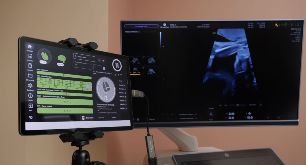 GE HealthCare Strengthens AI Offerings with Diagnoly Collaboration