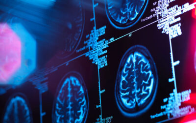 Will AI Replace the Radiologist? 5 years later.