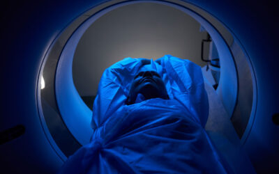 AI Detects First Imaging Biomarker of Chronic Stress