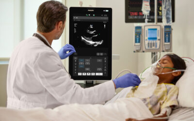 Philips Flash Ultrasound System 5100 POC