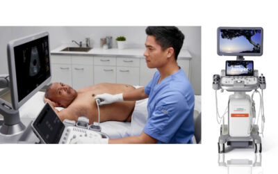 Siemens Healthineers ACUSON Juniper