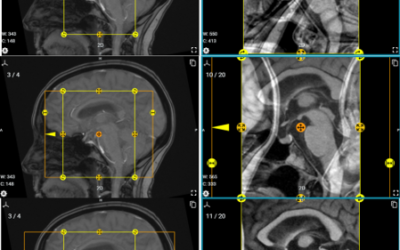 ScanLabMR Unveils MRI Simulation Upgrade Enabling Realistic Artifact Visualization