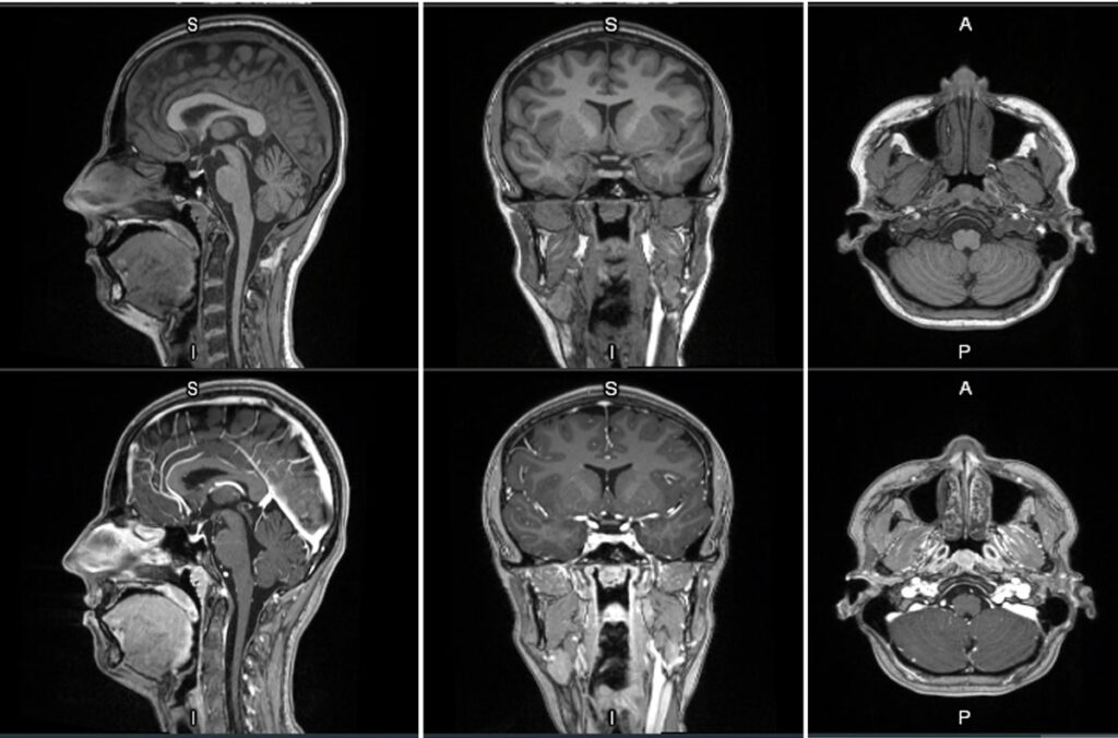 GE HealthCare announces first patient dosed in Phase 2/3 LUMINA trial for manganese-based MRI contrast agent

