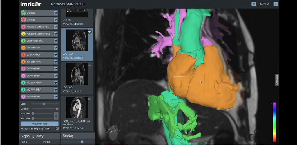 NorthStar Mapping System Available in U.S.

